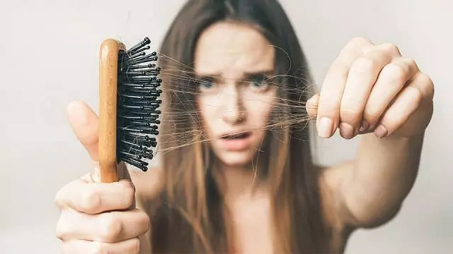 Check out all you need to know about hair loss