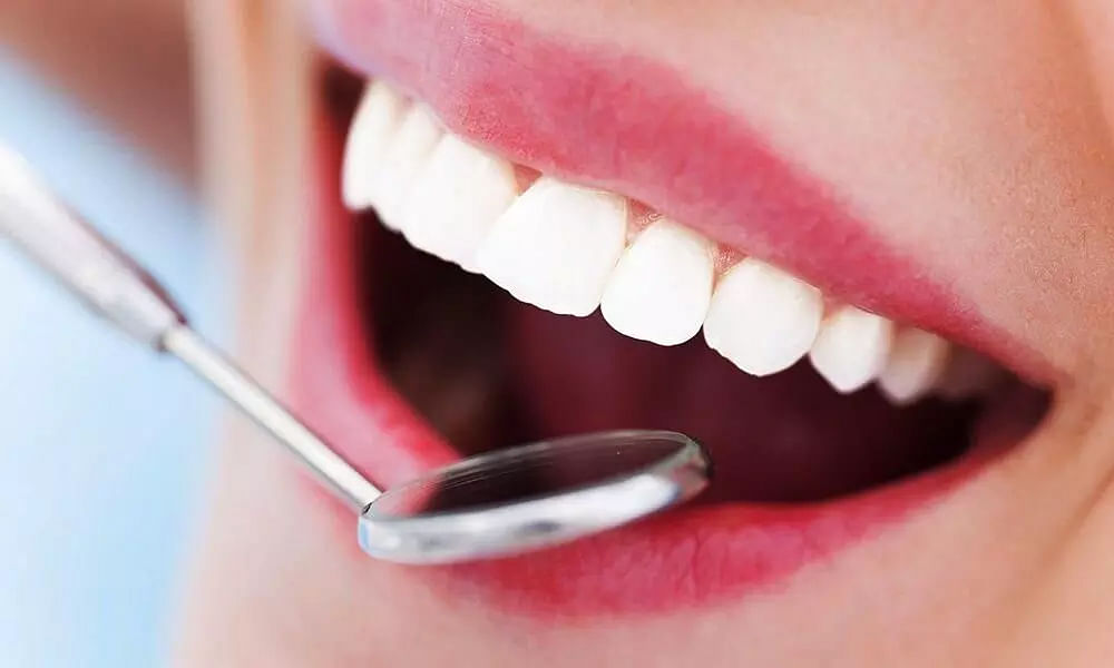 Home remedies for Gingivitis: everything you want to know